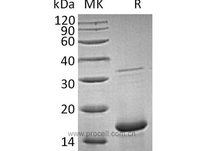 FGF-1/ FGFa/ FGF-acidic (Ala2-Asp155), Human, Recombinant