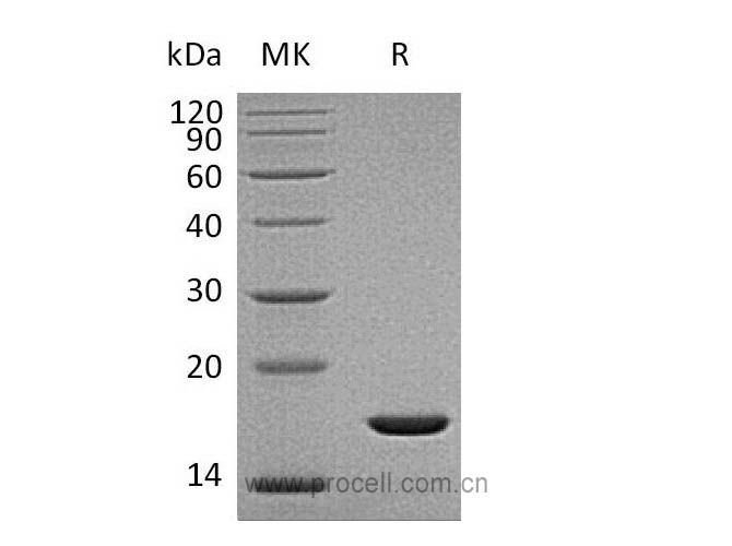 FGF-2/ bFGF/ FGF-b (Gly132-Ser288), Human, Recombinant