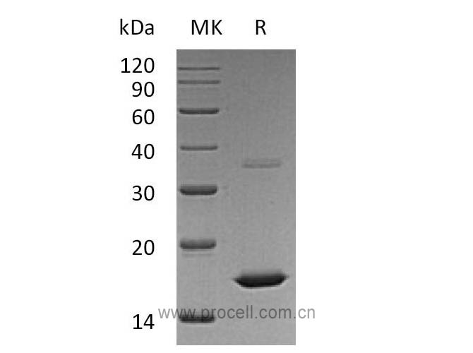 FGF-2/ bFGF/ FGF-b (Met134-Ser288), Human, Recombinant