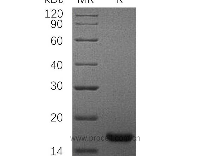 SCF/ c-Kit (C-6His), Rat, Recombinant