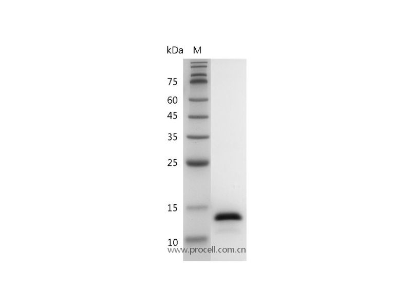 IL-2/TCGF/Aldesleukin, Human, Recombinant