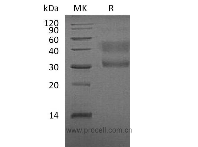 HGF R/ c-Met/ HGFR, Human, Recombinant