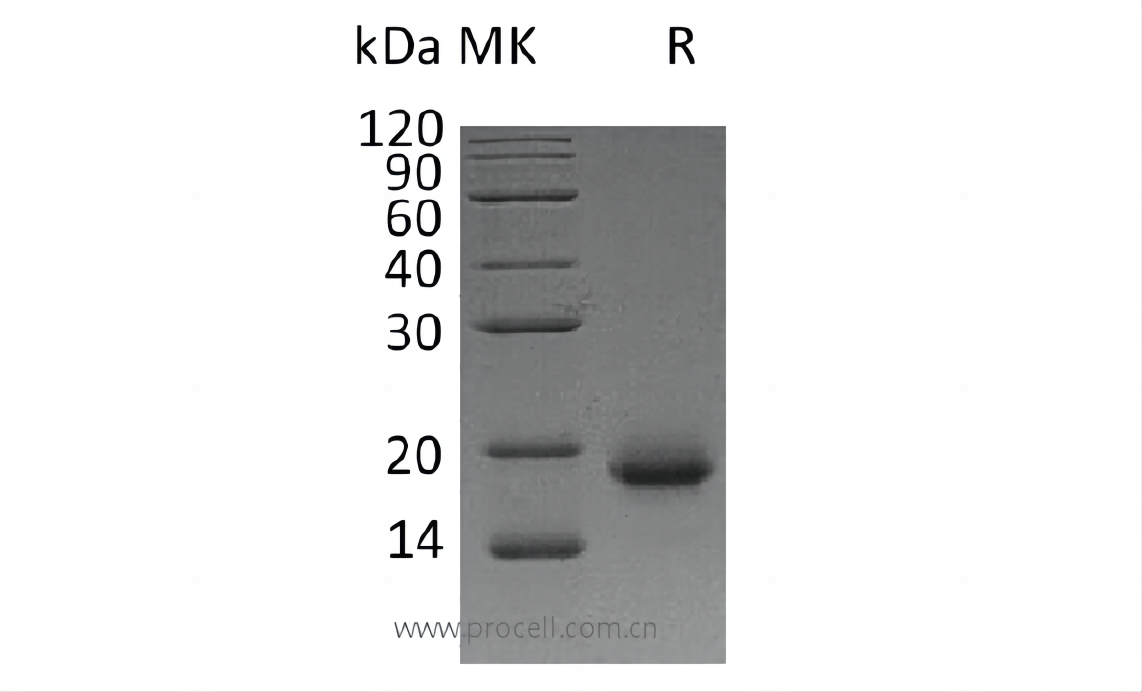 IL-4/ BSF-1 (Cells), Human, Recombinant