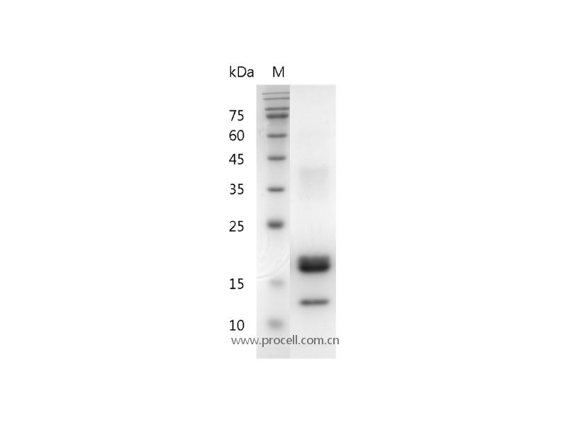 M-CSF/CSF-1/MGI-IM, Human, Recombinant