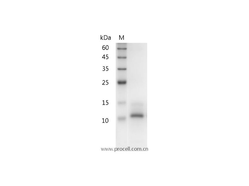 IL-15/IL-T, Human, Recombinant