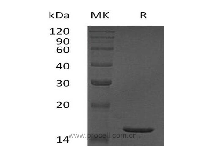 TNF-α/ TNFA/ TNFSF2, Human, Recombinant