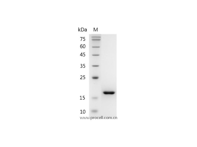 TNF-α/TNFA/TNFSF2, Mouse, Recombinant