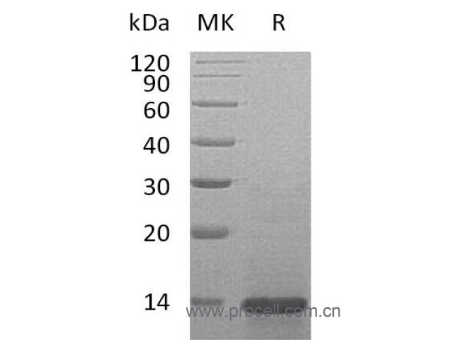 β-NGF/ NGF/ NGFB (Ser122-Gly241), Mouse, Recombinant (暂不出售)