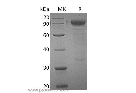 Procell-IL-3RA, Human, Recombinant