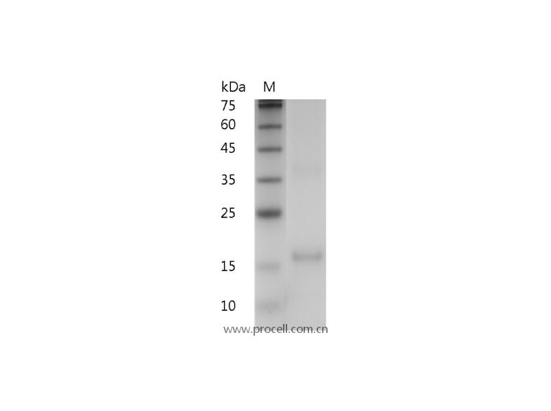 IL-7/LP-1, Human, Recombinant