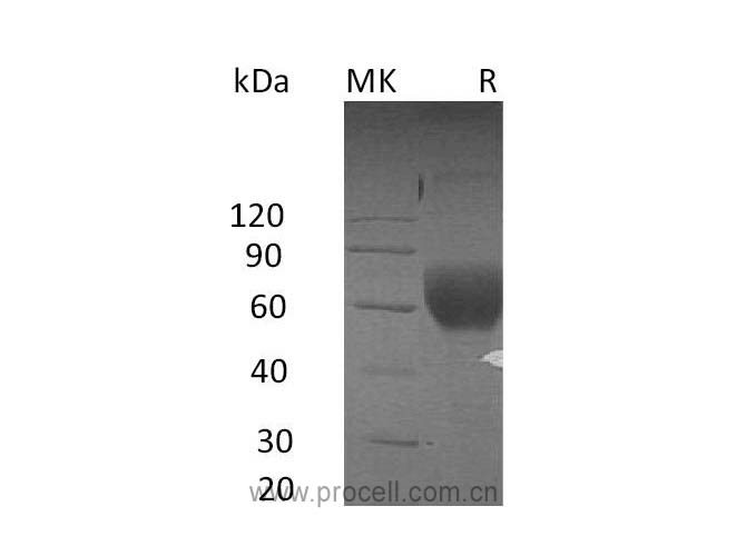 Procell-TGFβR2/ TGFBR2, Human, Recombinant