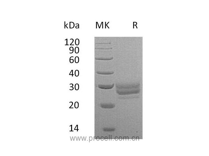 Flt-3L/ Flt3LG (C-6His), Mouse, Recombinant