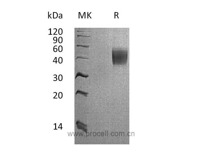 Procell-IL-4Ra (C-6His), Cynomolgus, Recombinant