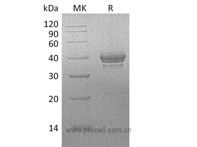 Procell-BCMA/ TNFRSF17 (C-Fc), Human, Recombinant