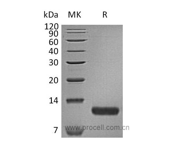 TARC/ CCL17 (C-6His), Human, Recombinant