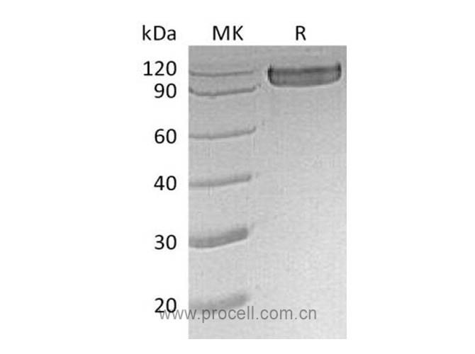 CD30/ TNFRSF8 (C-Fc), Human, Recombinant