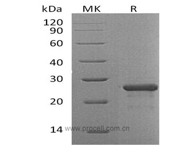 FGF-19 (N-6His), Human, Recombinant