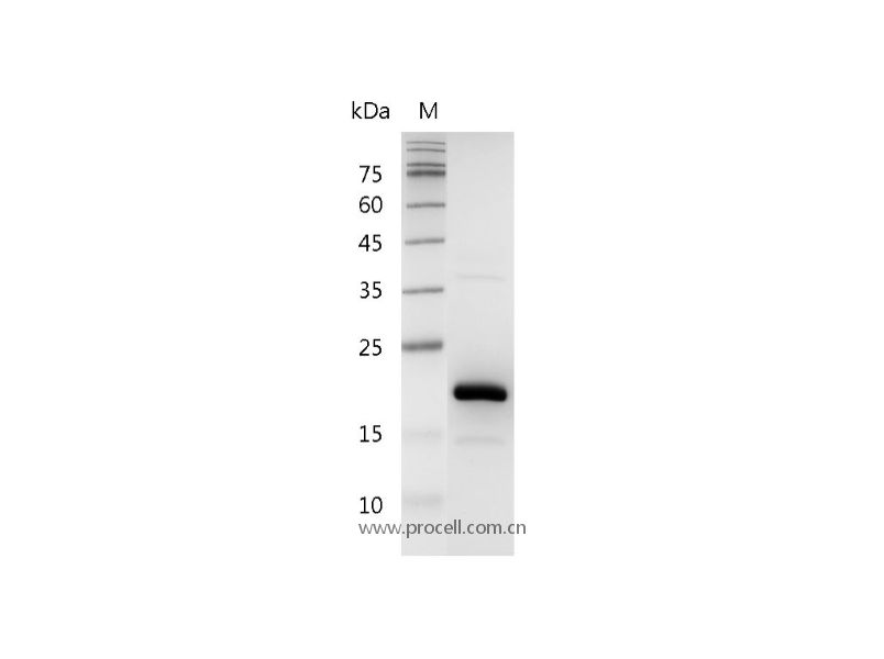 FGF-4/HST-1/HBGF-4, Human, Recombinant