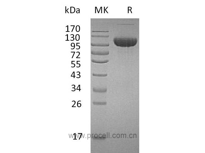 Procell-FGFR-3/ CD333/ FGFR3 (C-Fc), Human, Recombinant