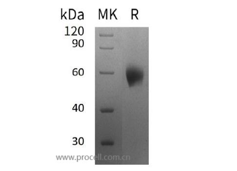 Procell-IL-1RAcP/ IL-1R3/ IL-1F6 (C-6His), Human, Recombinant