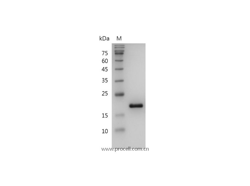 IL-1RA/ICIL-1RA/IRAP/IL-1RN, Human, Recombinant