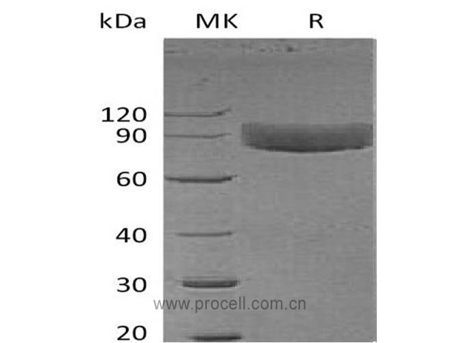 IL-1R-1/ CD121a (C-Fc), Human, Recombinant