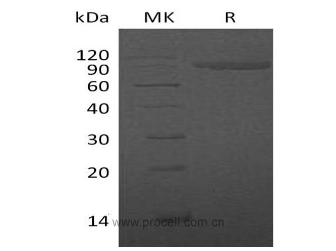 Procell-IL-1R-2/ CD121b (C-Fc), Human, Recombinant