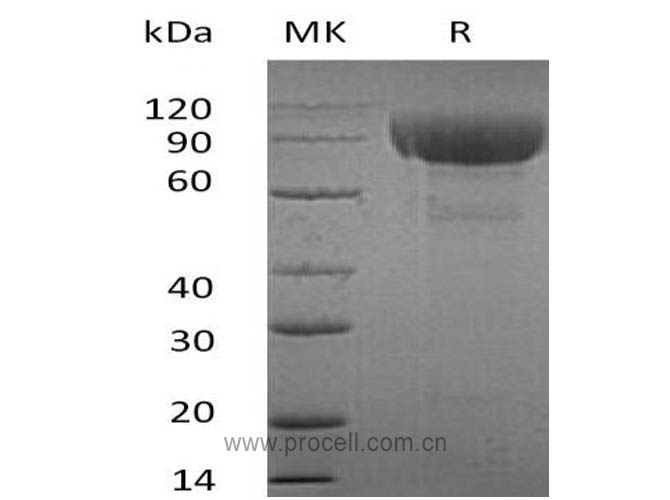 IL-1RL2 (C-Fc), Human, Recombinant