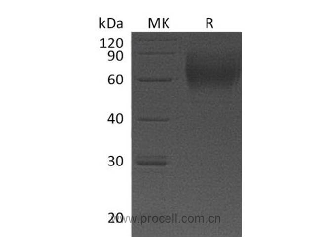 IL-23R (C-6His), Human, Recombinant