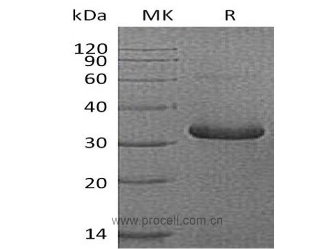 Procell-IGFBP1/ IBP-1 (C-6His), Human, Recombinant