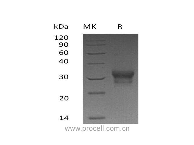 Procell-IFN-λ1/ IL-29 (C-10His), Human, Recombinant