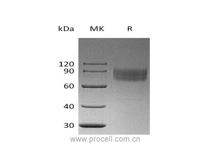 IFNAR1 (C-6His), Human, Recombinant