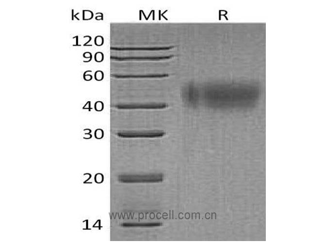 Procell-IFNAR2 (C-6His), Human, Recombinant