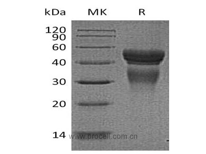 Procell-IL-12/ IL12A, Human, Recombinant