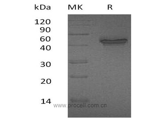 Procell-IL-12B/ IL-12 p40, Human, Recombinant