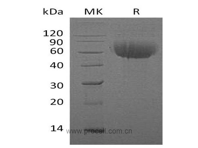 IL-13RA1/ IL13RA, Human, Recombinant