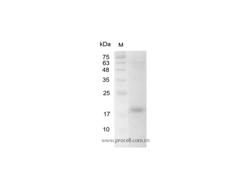 IL-16/LCF, Human, Recombinant