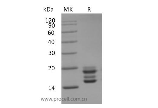 IL-17A/ CTLA8 (C-6His), Human, Recombinant