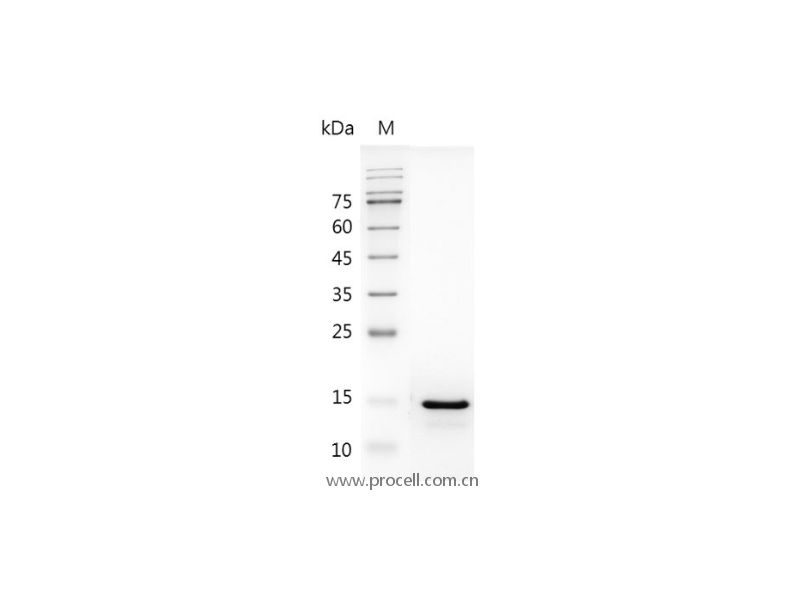 IL-18/IGIF/IL-1g/IL1F4, Human, Recombinant