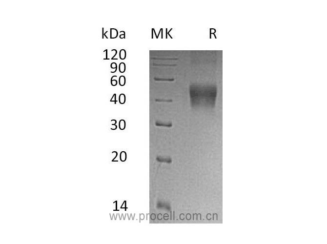 IL-21R/ CD360, Human, Recombinant