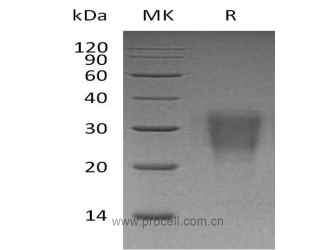 IL-22 (C-6His), Human, Recombinant