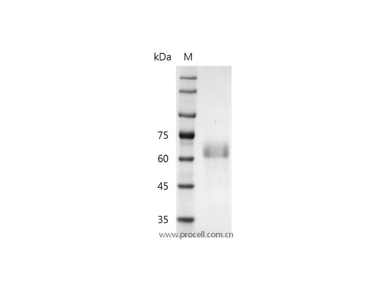 R-spondin 1/RSPO1, Human, Recombinant