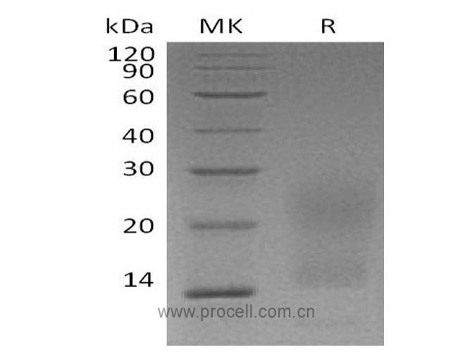 Procell-TNFRSF17/ BCMA/ CD269 (C-6His), Human, Recombinant