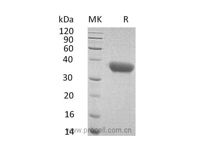 CXCL16/ SR-PSOX (C-6His), Mouse, Recombinant