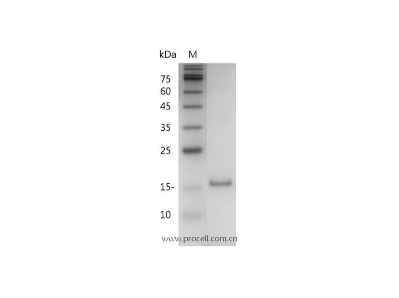 IL-10/B-TCGF/CSIF/TGIF, Mouse, Recombinant