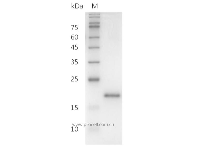 IL-10/B-TCGF/CSIF/TGIF, Human, Recombinant