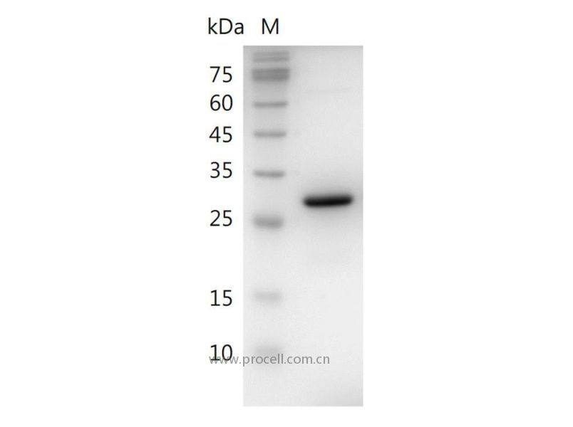 HMGB1/HMG-1/HMG1/HMG3/SBP-1, Human, Recombinant