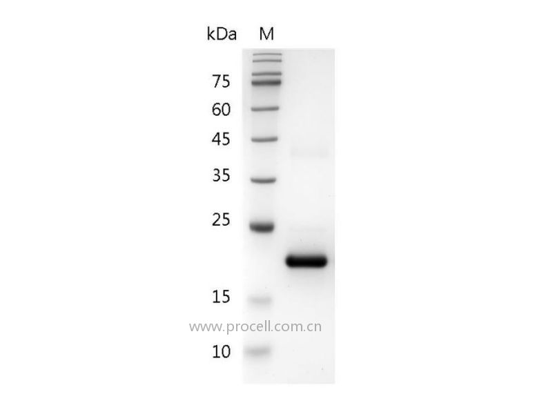 IFNα 1a/IFNA2, Human, Recombinant