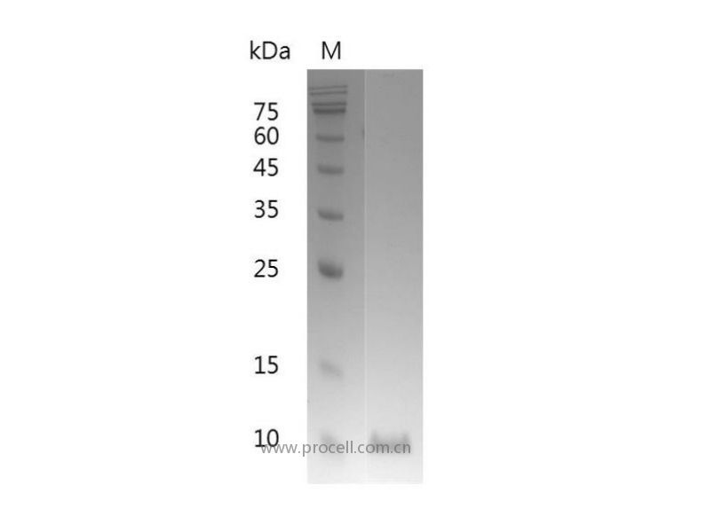 MIF/GLIF/GIF, Human, Recombinant