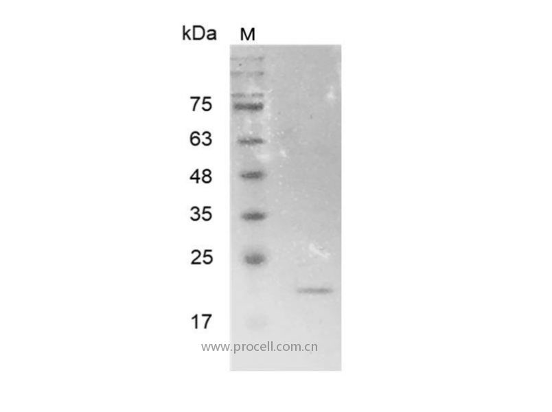 MMP7/MPSL1/PUMP-1, Human, Recombinant